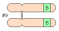 9番染色体 BB型